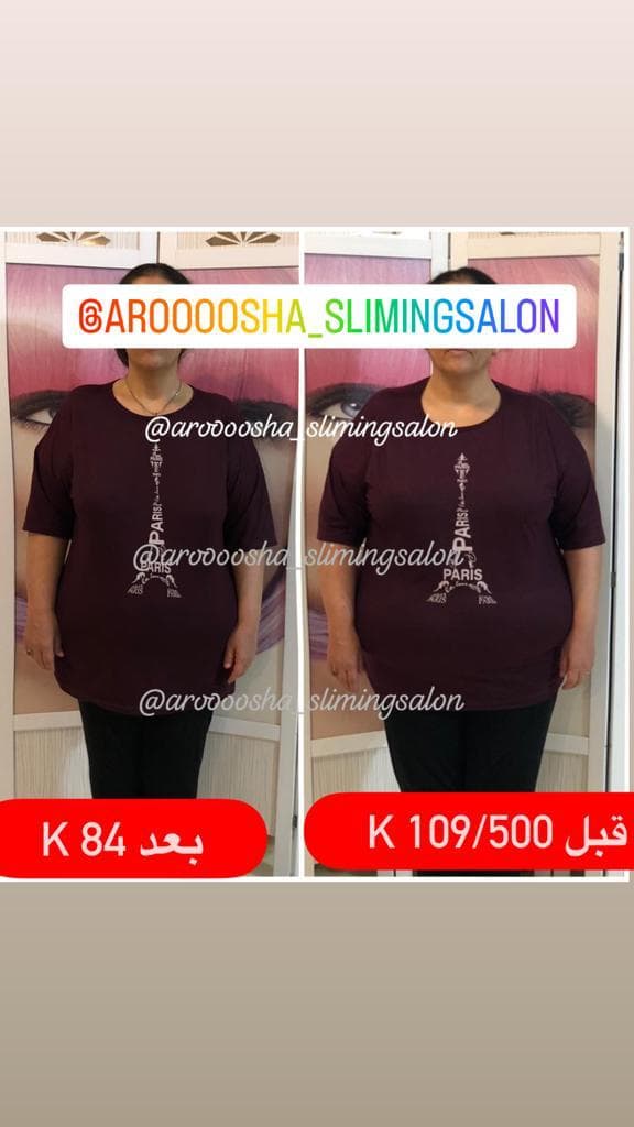 مرکز لاغری تضمینی و تخصصی آروشا در اندیشه شهریار