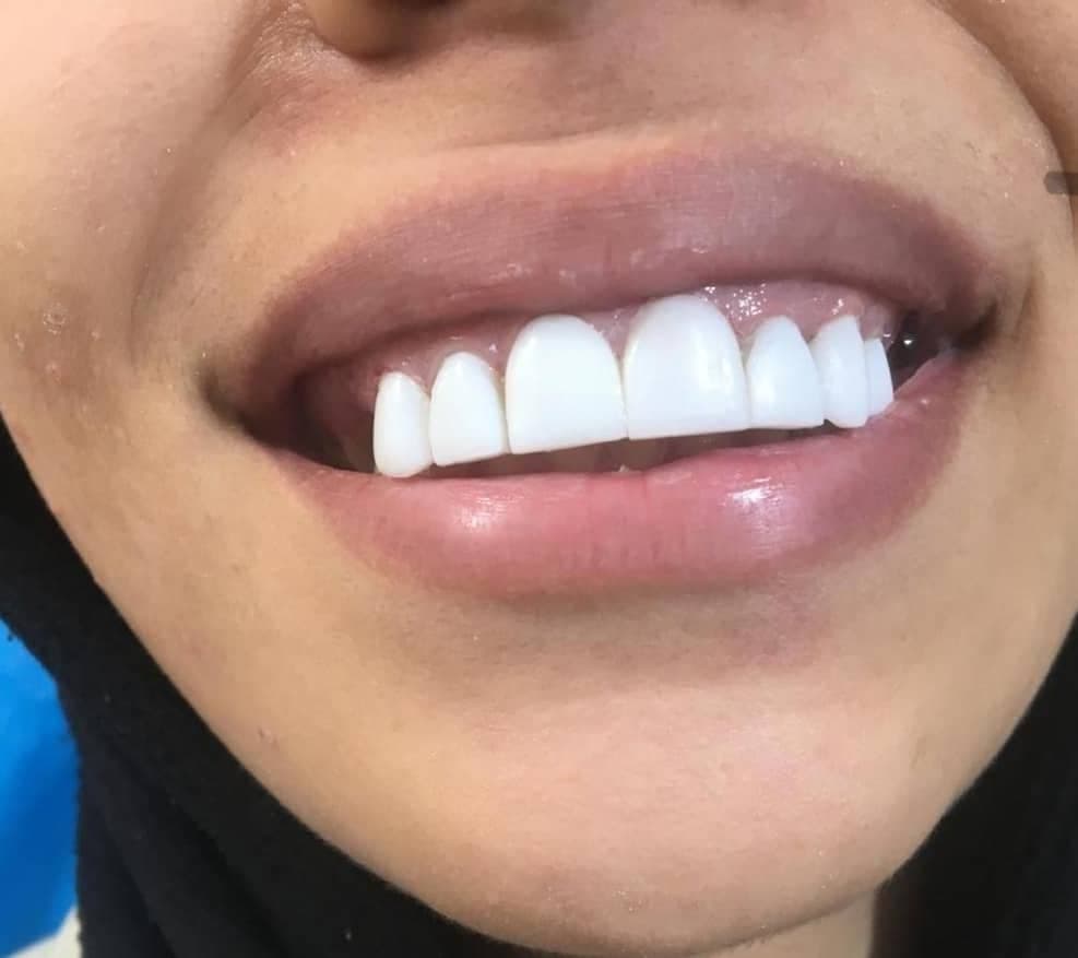 لابراتوار پروتز دندانسازی احمدی در تبریز