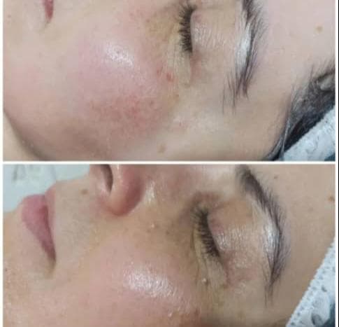کلینیک زیبایی و لیزر ریبرس در بم