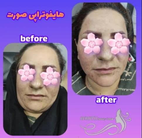کلینیک زیبایی و لیزر ریبرس در بم