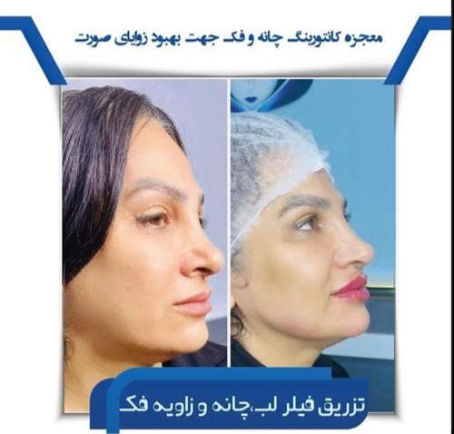 کلینیک تخصصی زیبایی جوانسازی موراشین در بلوار فردوس تهران