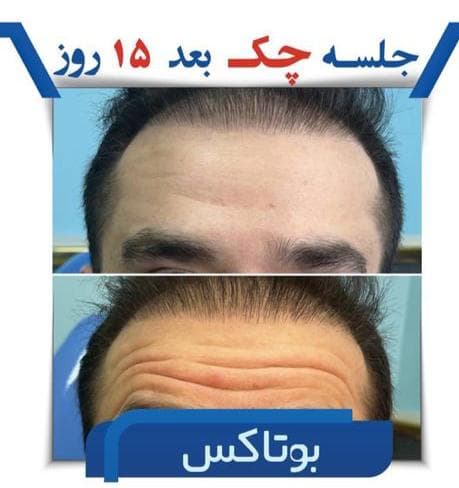 کلینیک تخصصی زیبایی جوانسازی موراشین در بلوار فردوس تهران