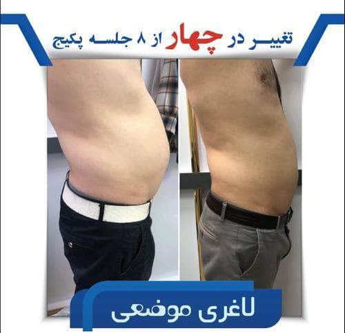 کلینیک تخصصی زیبایی جوانسازی موراشین در بلوار فردوس تهران