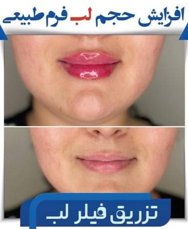 کلینیک تخصصی زیبایی جوانسازی موراشین در بلوار فردوس تهران