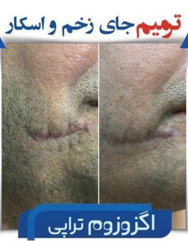 کلینیک تخصصی زیبایی جوانسازی موراشین در بلوار فردوس تهران