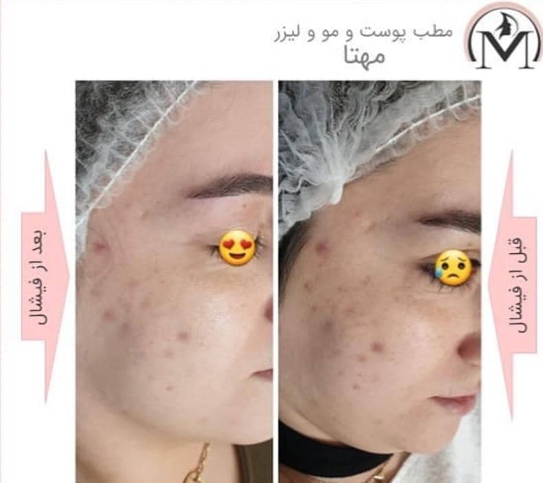 مرکز تخصصی زیبایی و لیزر مهتا در تبریز
