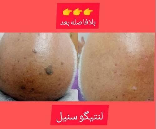 مطب زیبایی لیزر دکتر بهراد در گلوبندک تهران