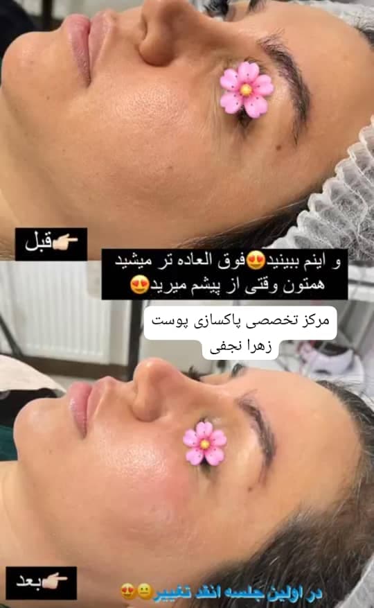 آموزشگاه فنی حرفه ای پاکسازی پوست زهرا نجفی در نظرآباد