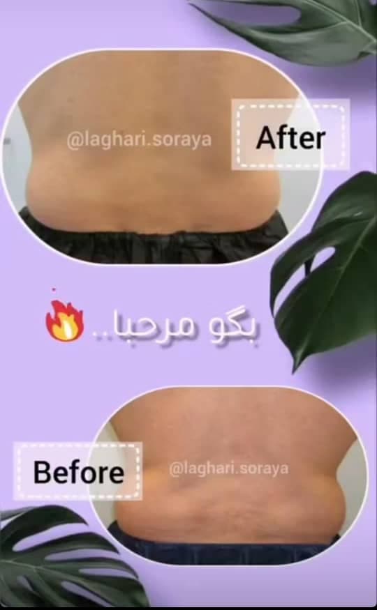 کلینیک لاغری ثریا در مشهد