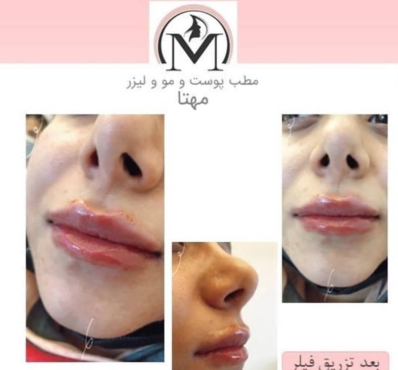 مرکز تخصصی زیبایی و لیزر مهتا در تبریز