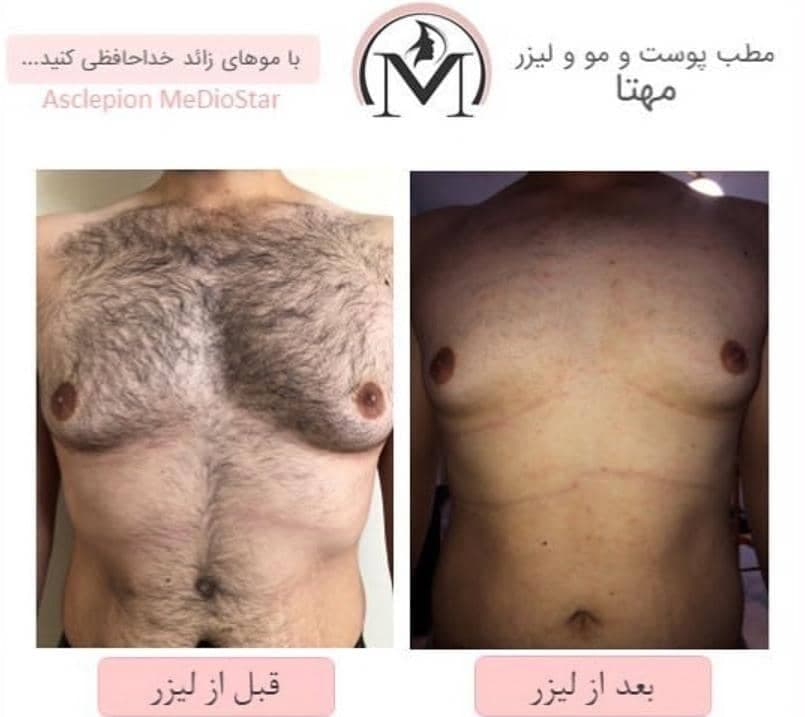 مرکز تخصصی زیبایی و لیزر مهتا در تبریز