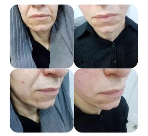 مطب زیبایی لیزر دکتر بهراد در گلوبندک تهران