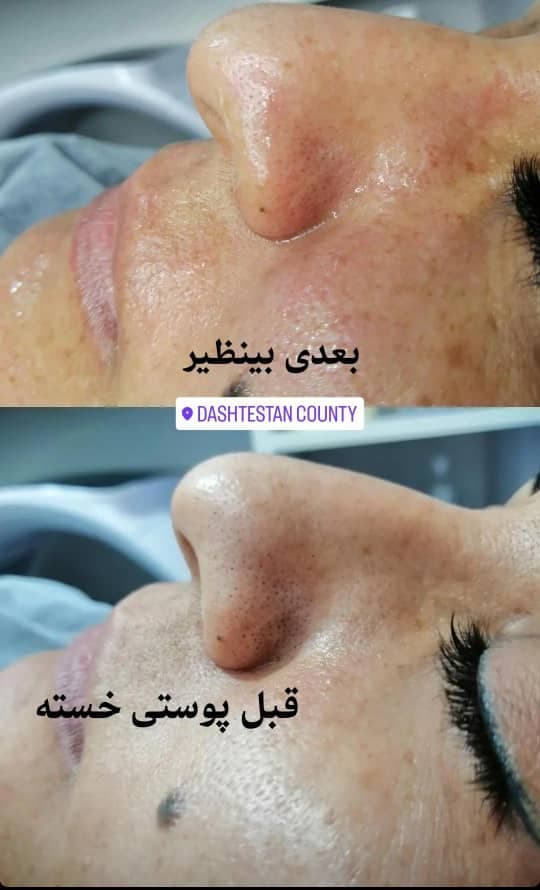 مرکز تخصصی آموزش پوست و مو ترنم در برازجان