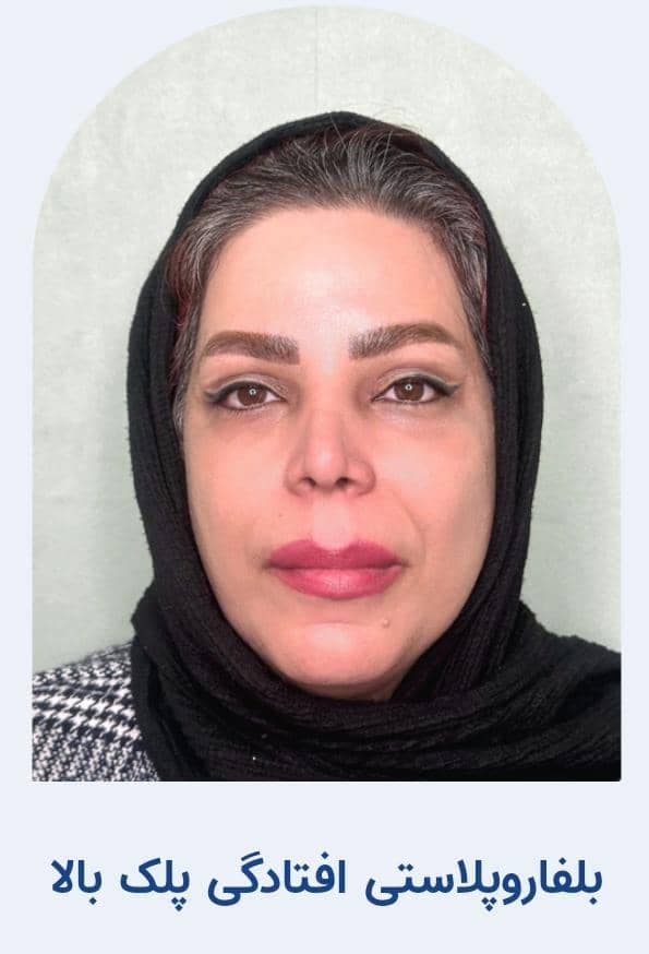 کلینیک تخصصی جراحی چشم و بلفاروپلاستی پلک کولایف در تهران