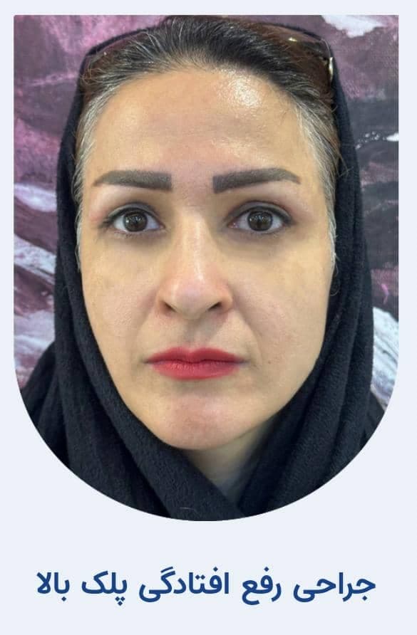 کلینیک تخصصی جراحی چشم و بلفاروپلاستی پلک کولایف در تهران