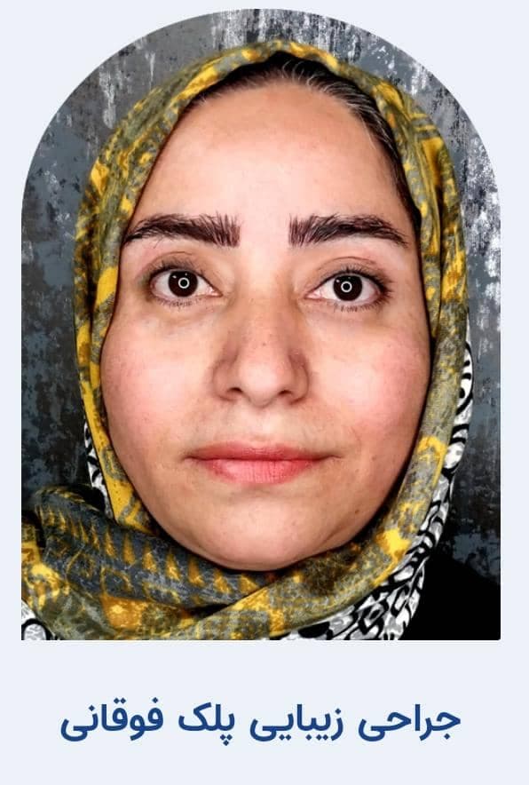 کلینیک تخصصی جراحی چشم و بلفاروپلاستی پلک کولایف در تهران