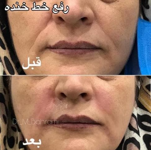 مرکز پوست و مو دکتر مهدیه بهرامی در کرمان