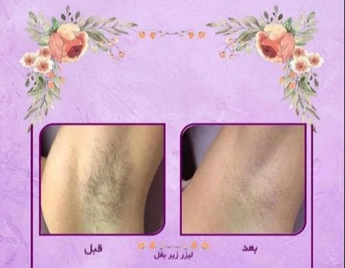 مطب زیبایی لیزر دکتر بهراد در گلوبندک تهران