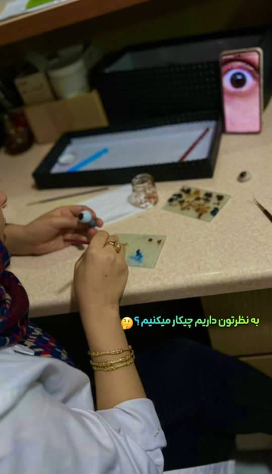 ساخت و طراحی پروتز چشم ارتو‌پد فنی یزدان در یزد