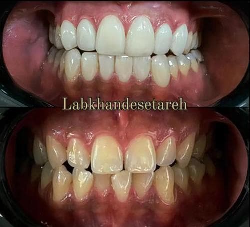 کلینیک دندانپزشکی لبخند ستاره در اصفهان