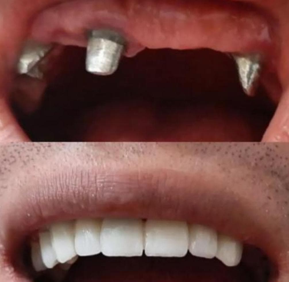 مطب دندانپزشکی لبخند در طالقانی شرقی گنبد کاووس