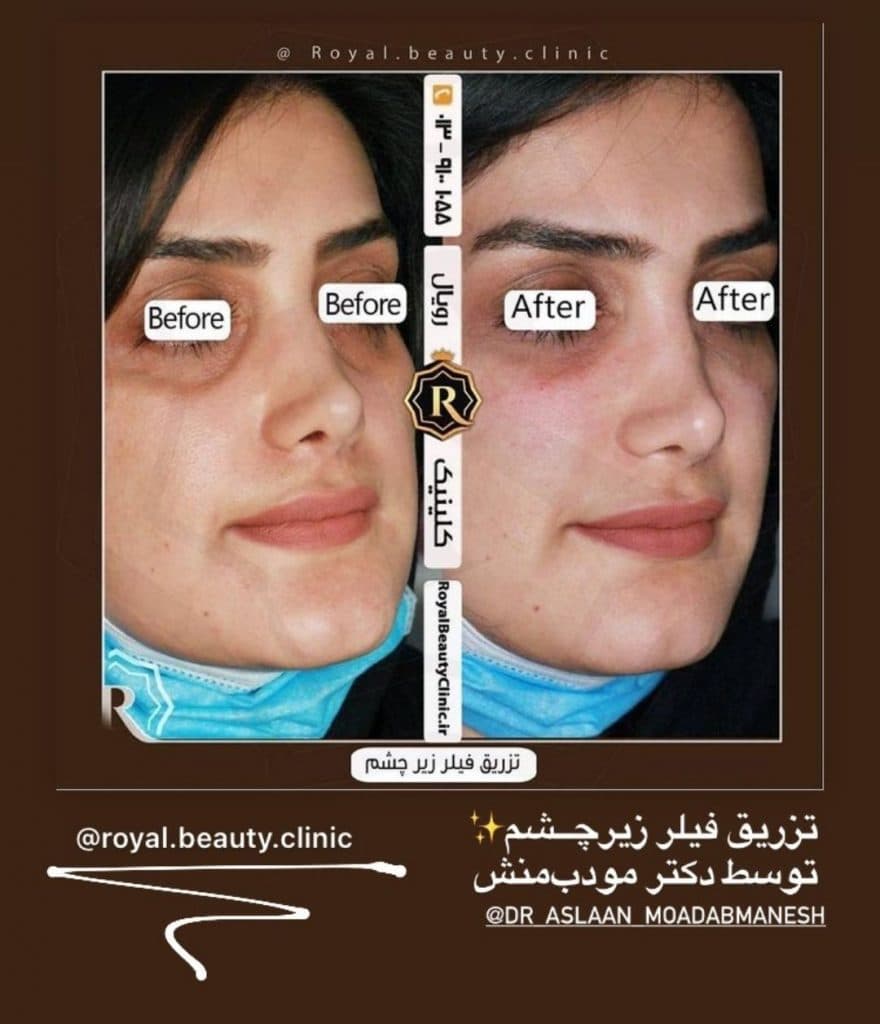 کلینیک زیبائی رویال در رشت