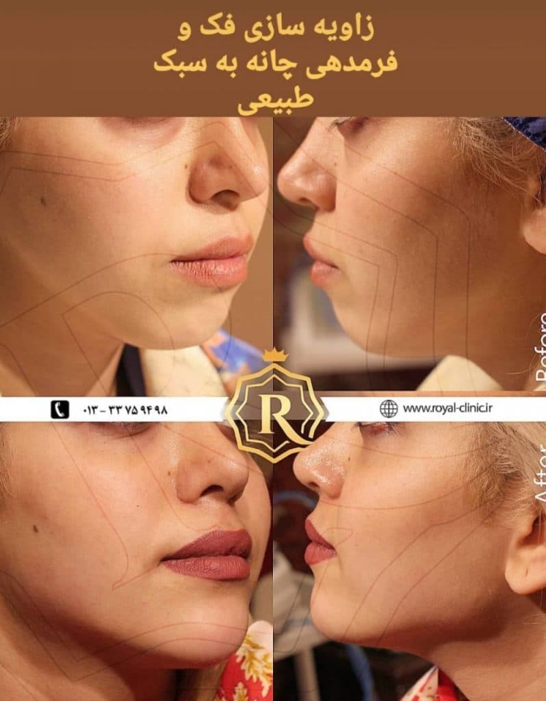 کلینیک زیبائی رویال در رشت