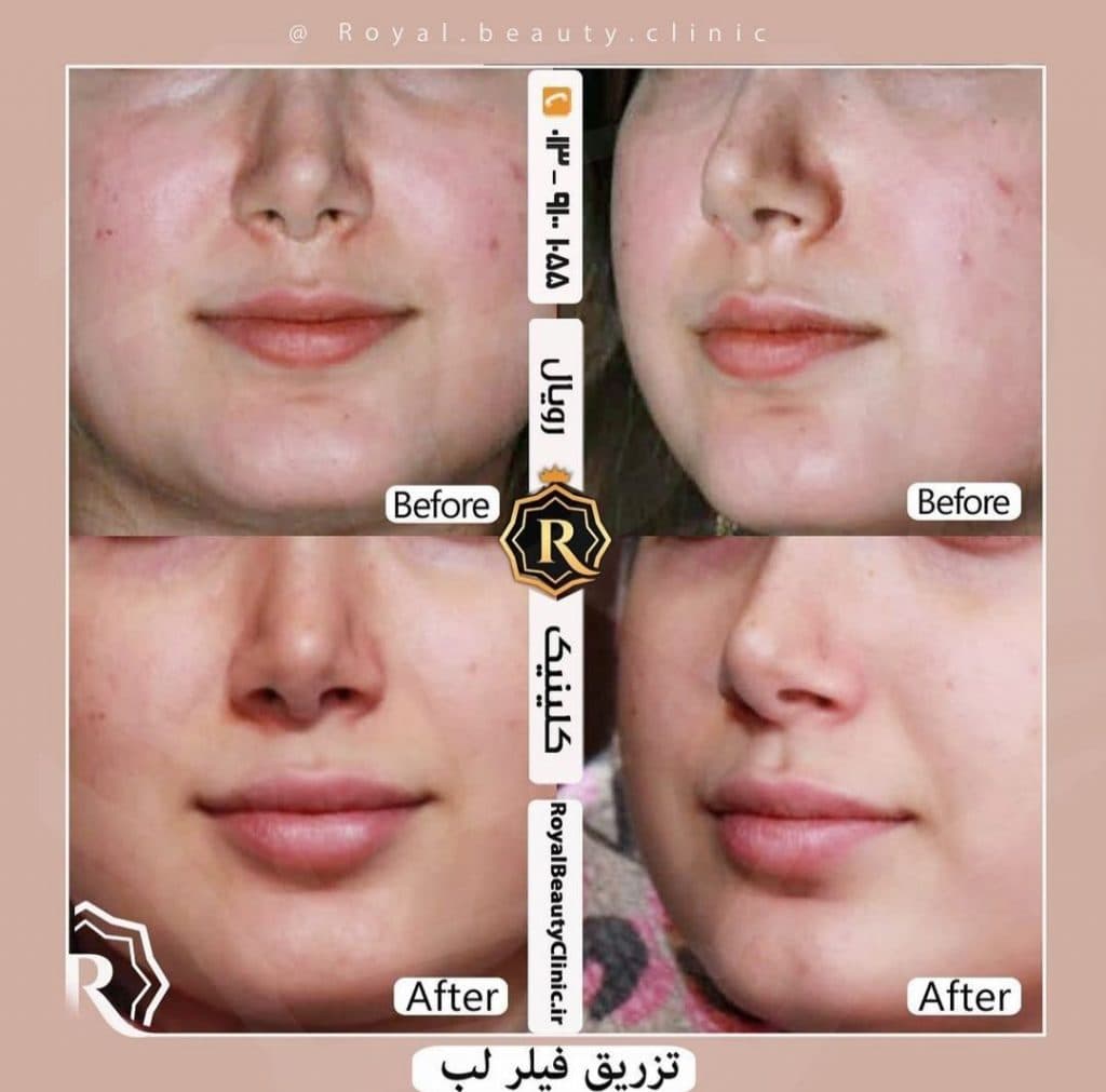 کلینیک زیبائی رویال در رشت