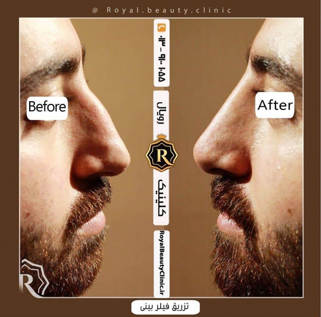 کلینیک زیبائی رویال در رشت