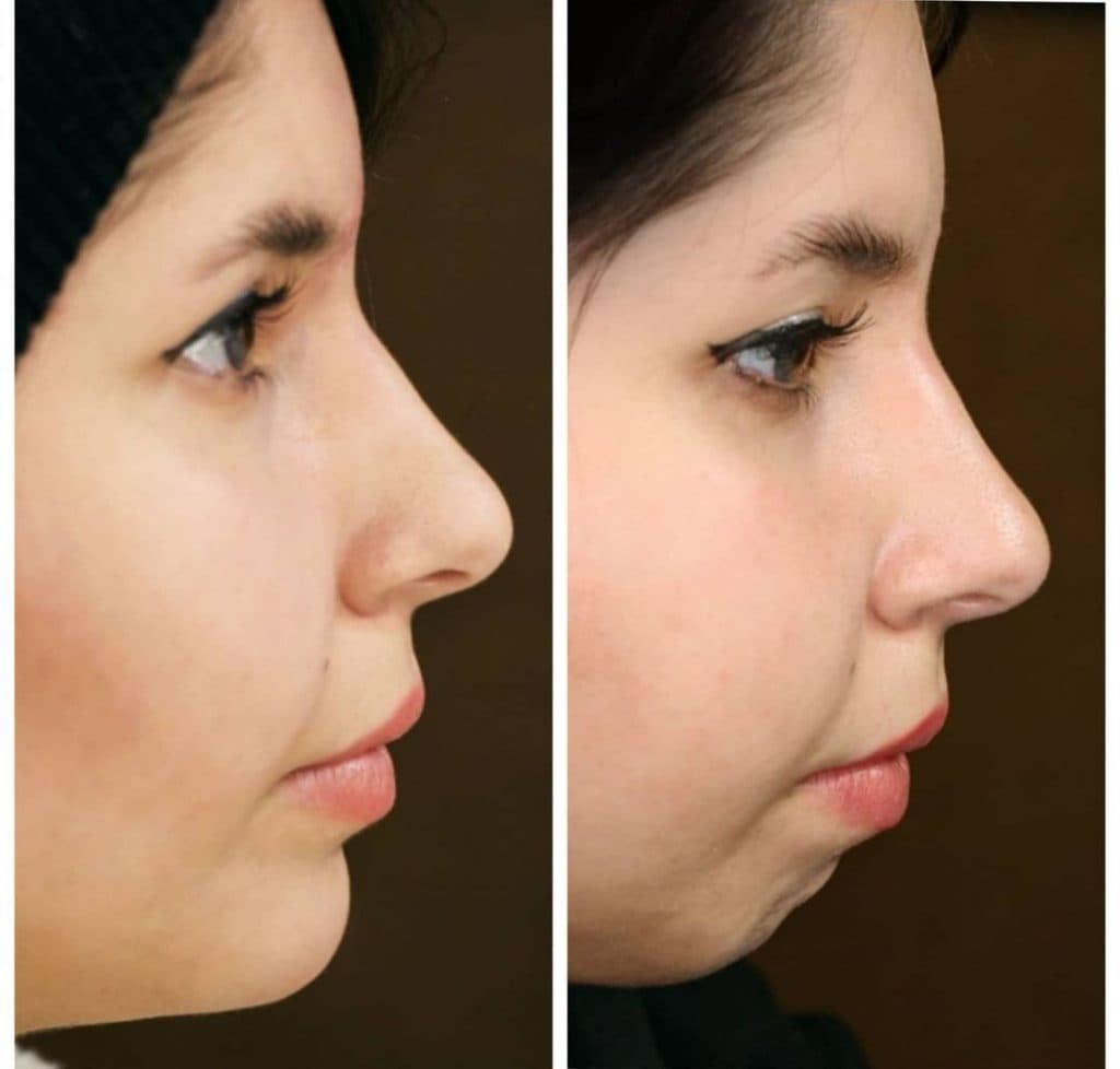 کلینیک زیبائی رویال در رشت