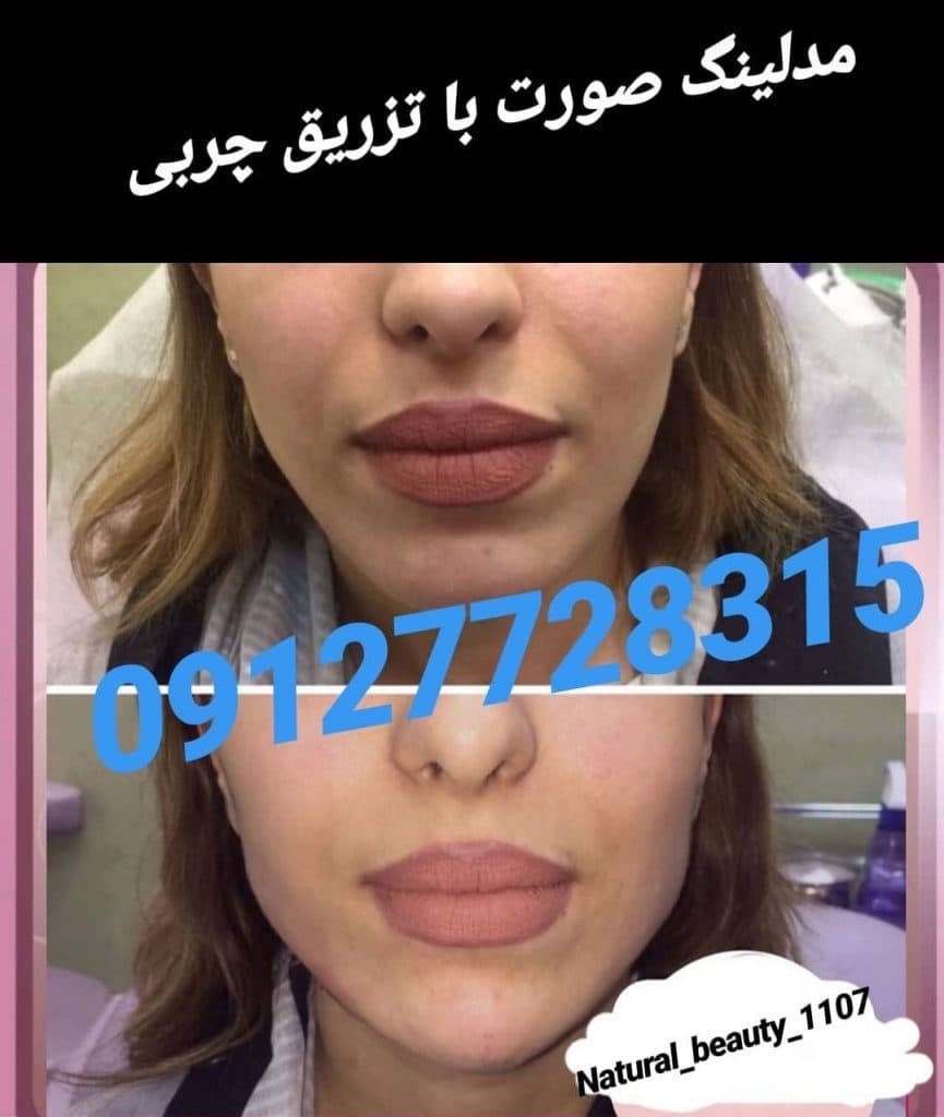 کلینیک زیبایی دکتر تقوی در تهران 