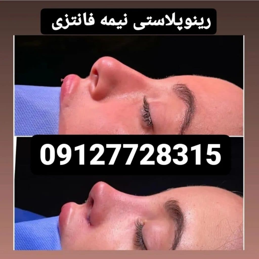 کلینیک زیبایی دکتر تقوی در تهران 