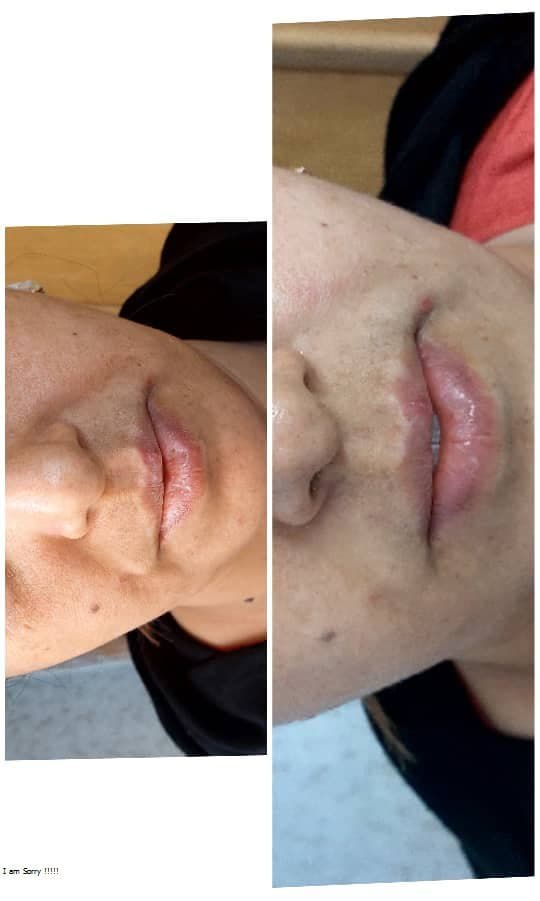 کلینیک زیبایی پوست و مو و لیزر سیب سبز در اصفهان