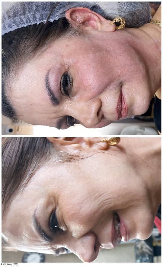کلینیک زیبایی پوست و مو و لیزر سیب سبز در اصفهان