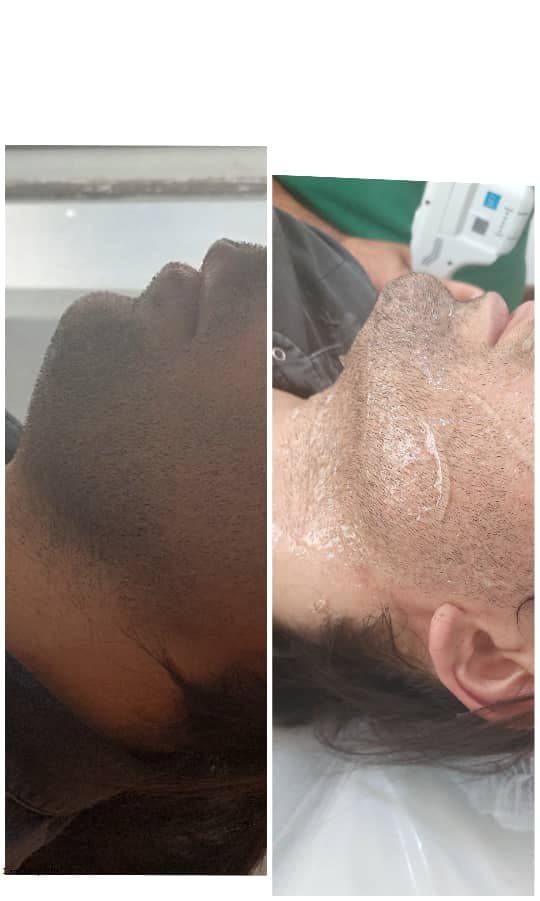 کلینیک زیبایی پوست و مو و لیزر سیب سبز در اصفهان
