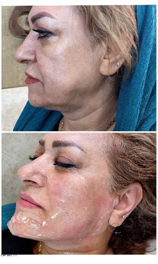 کلینیک زیبایی پوست و مو و لیزر سیب سبز در اصفهان