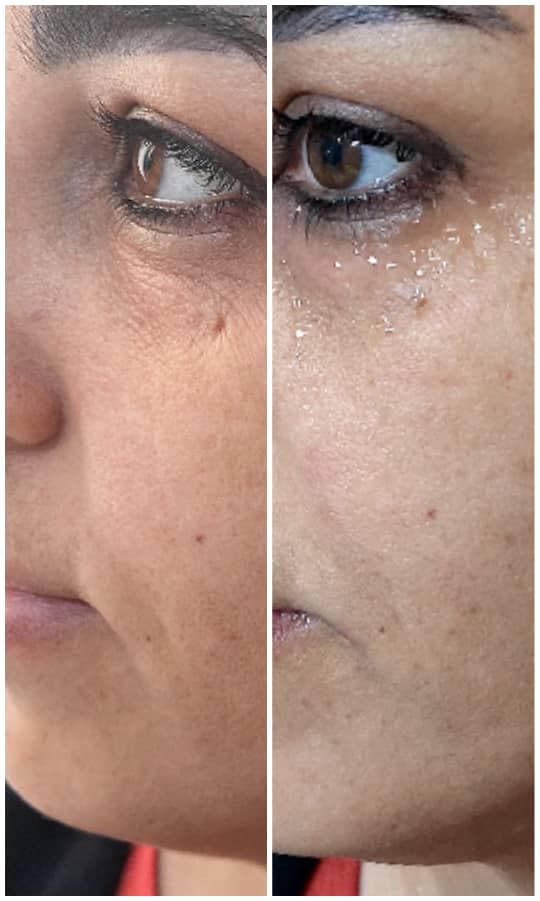 کلینیک زیبایی پوست و مو و لیزر سیب سبز در اصفهان