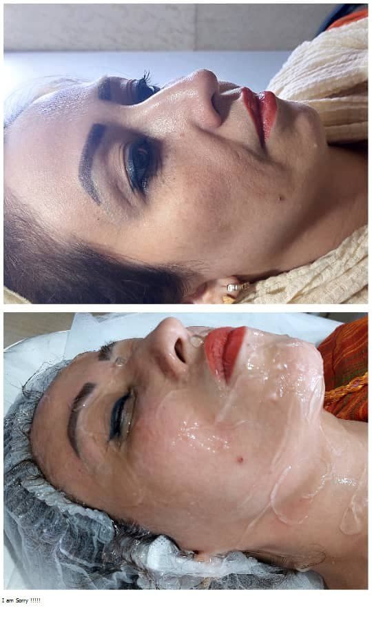 کلینیک زیبایی پوست و مو و لیزر سیب سبز در اصفهان