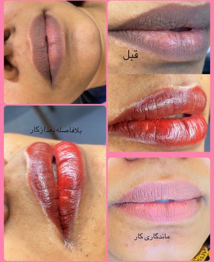 آموزش و خدمات شیدینگ و فیبروز ابرو هانیه پگاه در بندرعباس