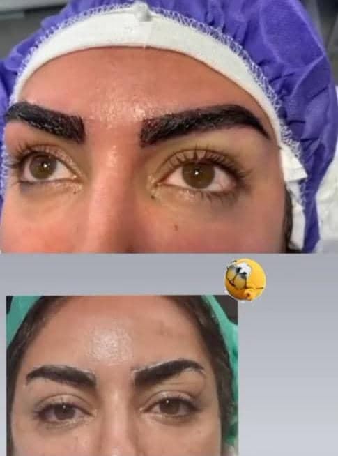 کاشت ابرو و مو شیما غربی در مشهد