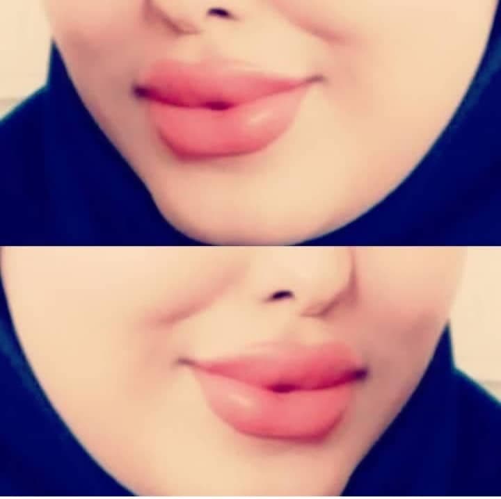 کلینیک زیبایی و لیزر اسرا در مشهد