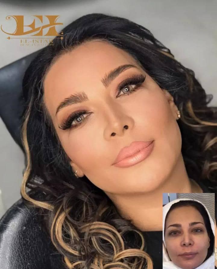سالن زیبایی و عروس سرا ال الیستر در کرج