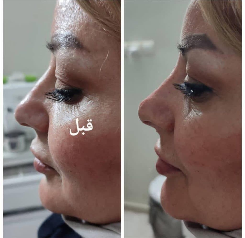 کلینیک تخصصی پوست مو زیبایی افرا در مشهد