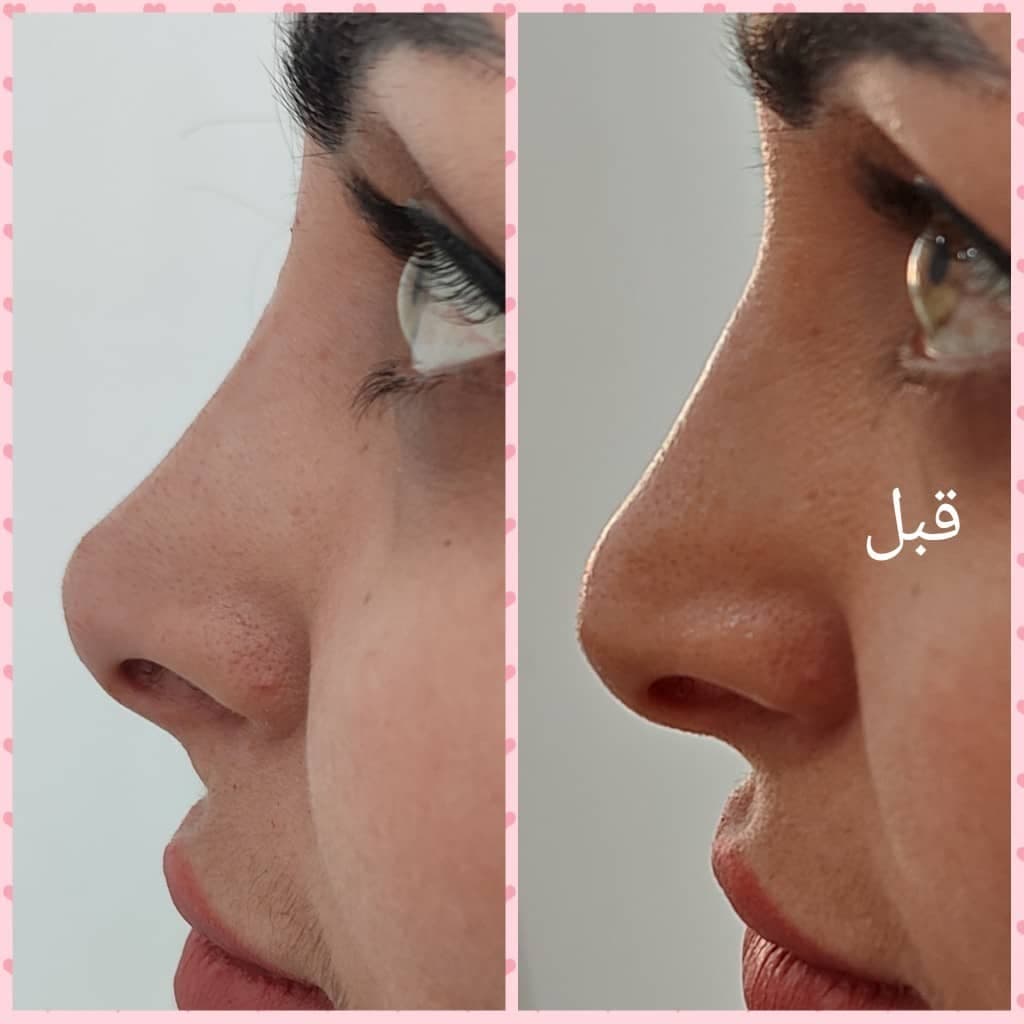 کلینیک تخصصی پوست مو زیبایی افرا در مشهد