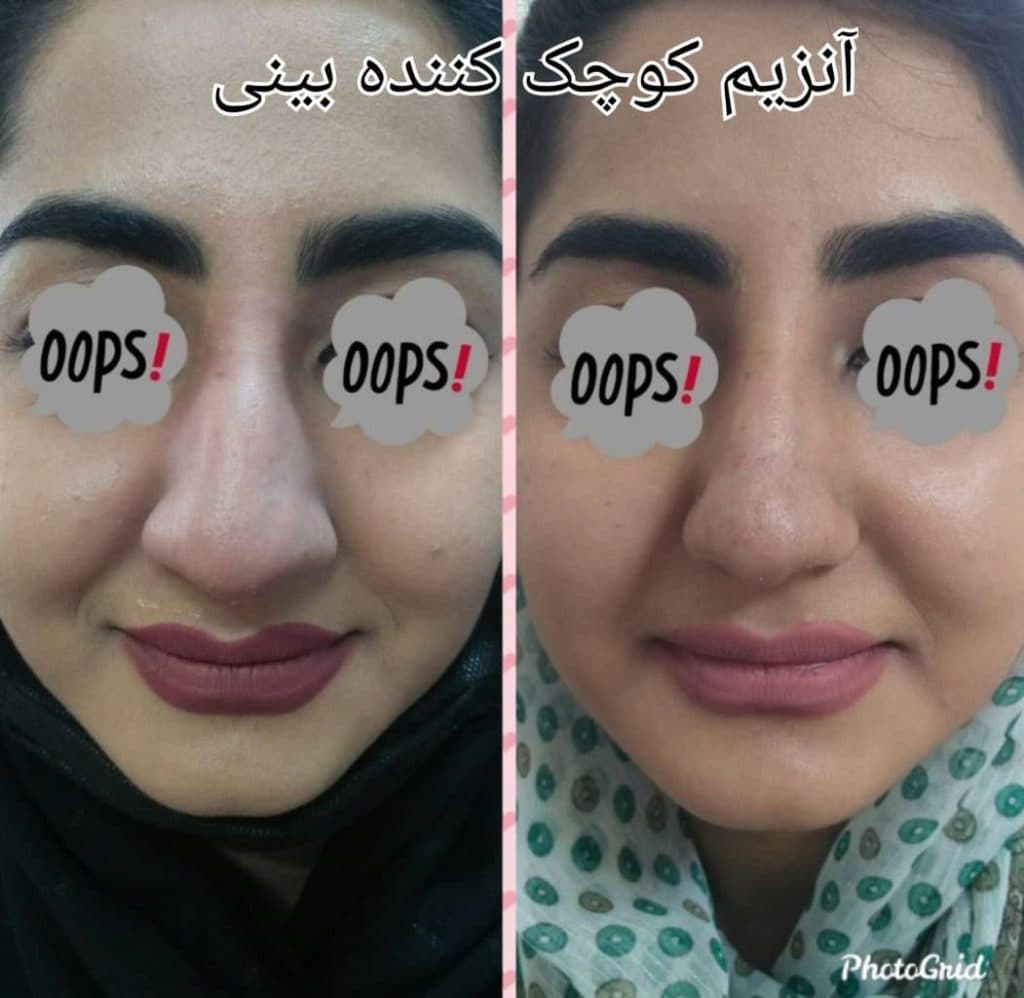 کلینیک تخصصی پوست مو زیبایی افرا در مشهد