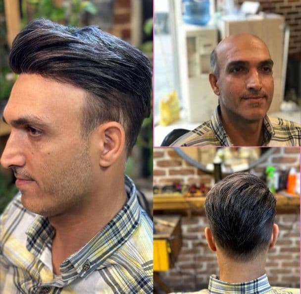 خدمات پروتز مو و میکروبلیدینگ با استایل مردانه محمد افلاک در قزوین