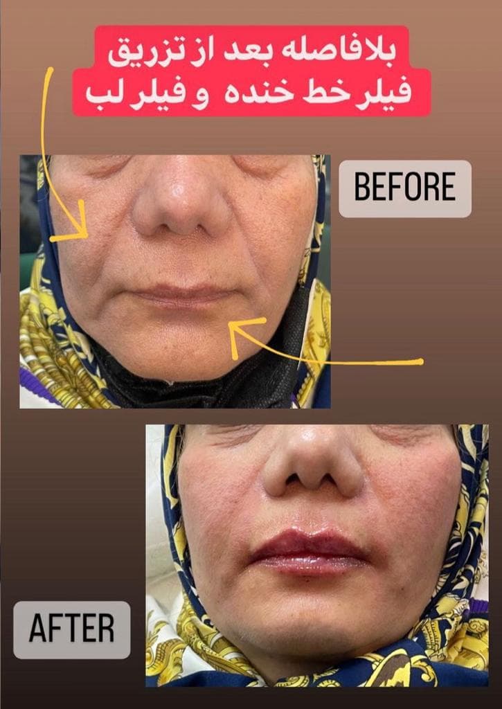 مرکز زیبایی پوست و لیزر و فیشال مون فیس در شیراز