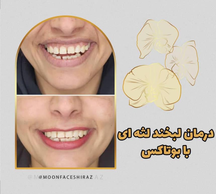 مرکز زیبایی پوست و لیزر و فیشال مون فیس در شیراز