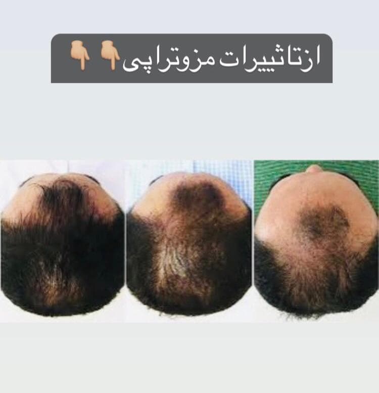 مرکز زیبایی پوست و لیزر و فیشال مون فیس در شیراز