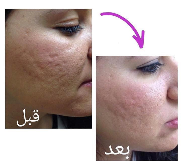 مرکز زیبایی پوست و لیزر و فیشال مون فیس در شیراز